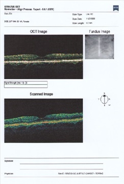 i multipli strati della retina visti dall'OCT