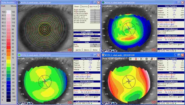 astigmatismo in topografia corneale