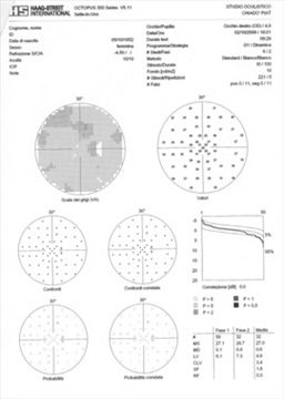 Perimetria computerizzata