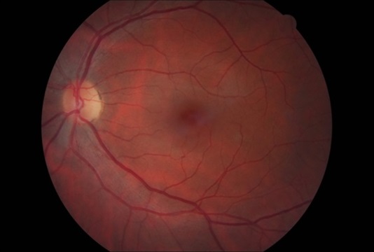 Retina fisiologica